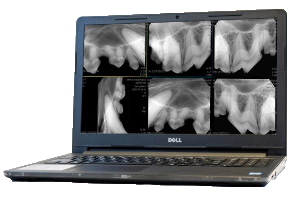 flex digital x ray camera with laptop