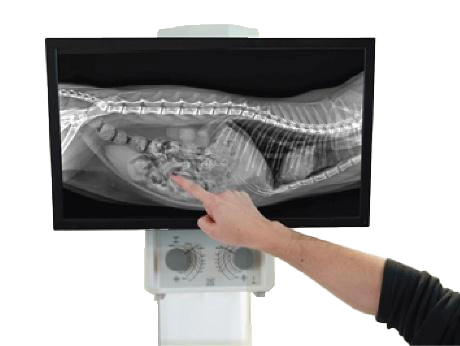 IWV System X Flat Panel X-Ray System 