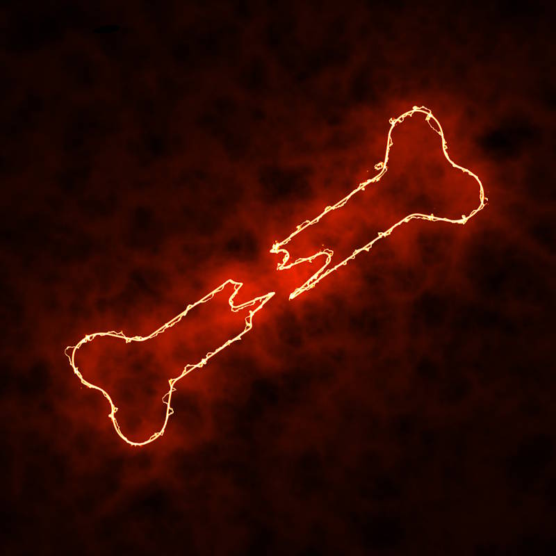 IWV Pain Measurement