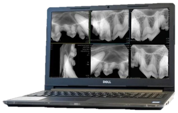 Acquisition laptop showing a full set of dental radiographs
